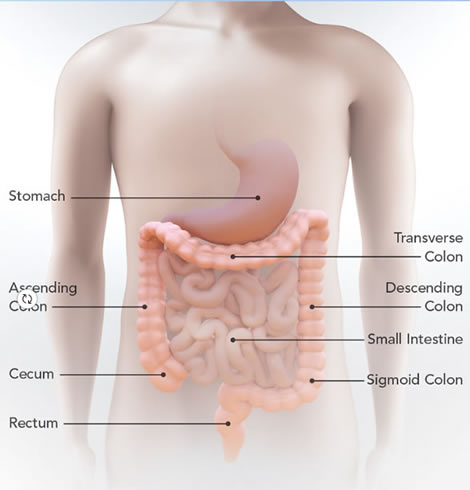 Colon Cancer Image